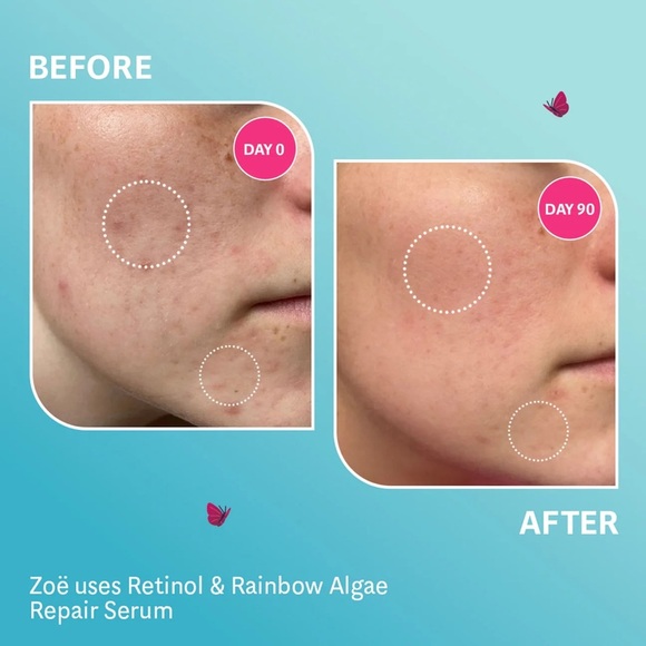 Selfless by Hyram Retinol & Rainbow Algae Repair Serum - Picture 9 of 12